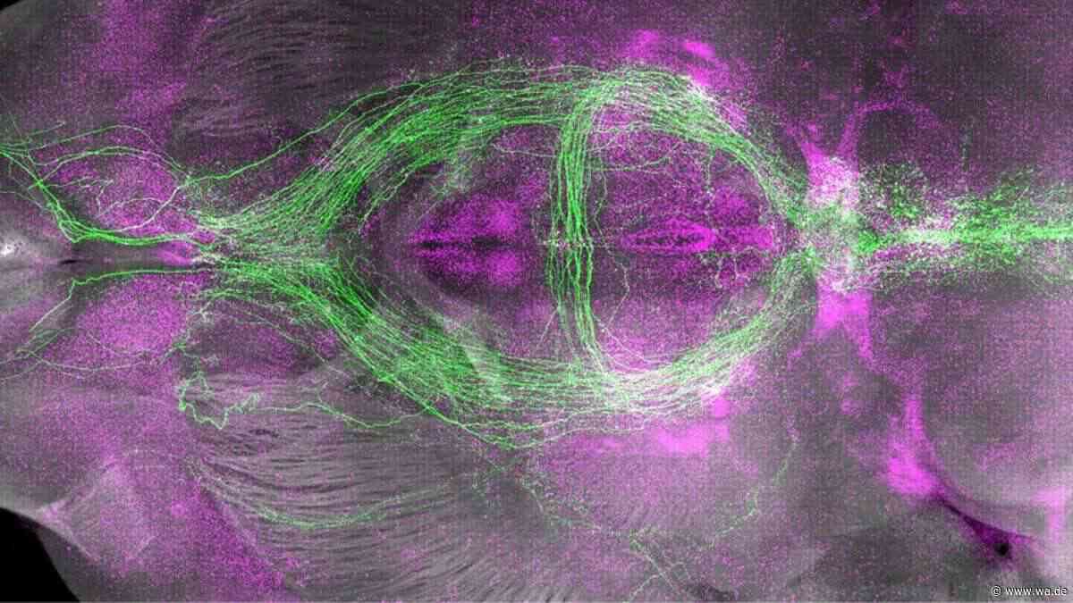 Forscher entdecken im Gehirn, warum wir müde werden