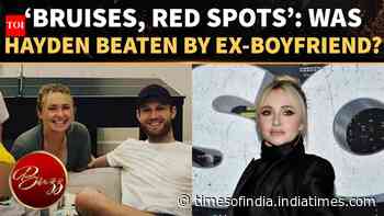 Hayden Panettiere Assaulted In Final Years? 'Bruised' Actor's Neighbour Reveals CHILLING Account