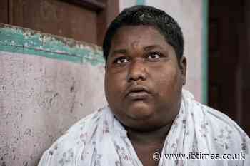 After Five Years Living in Ponds, West Bengal Teen Iqbal Sheikh Is Flown to Mumbai for Specialist Treatment