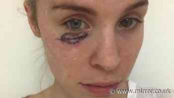 'I was diagnosed with skin cancer aged 26 - unethical sunscreen tax must end now'