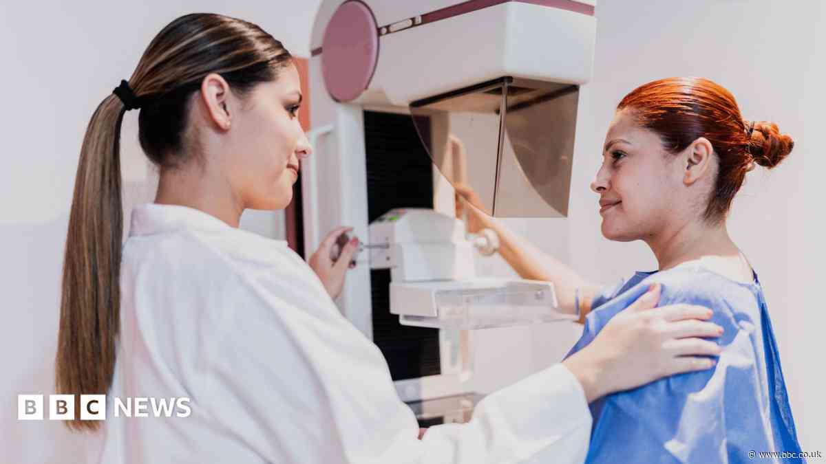 Breast cancer patterns found by AI could help treatment