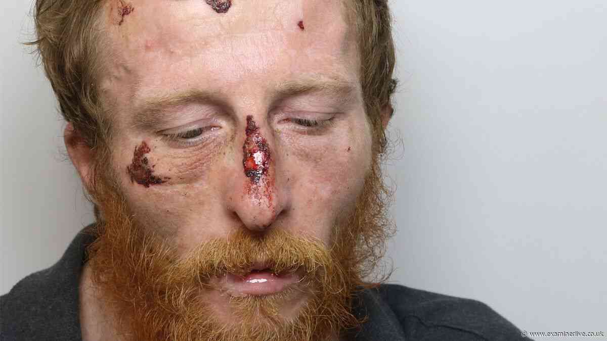 Thug with 'no reason' sets fire to tree in family's garden while they slept