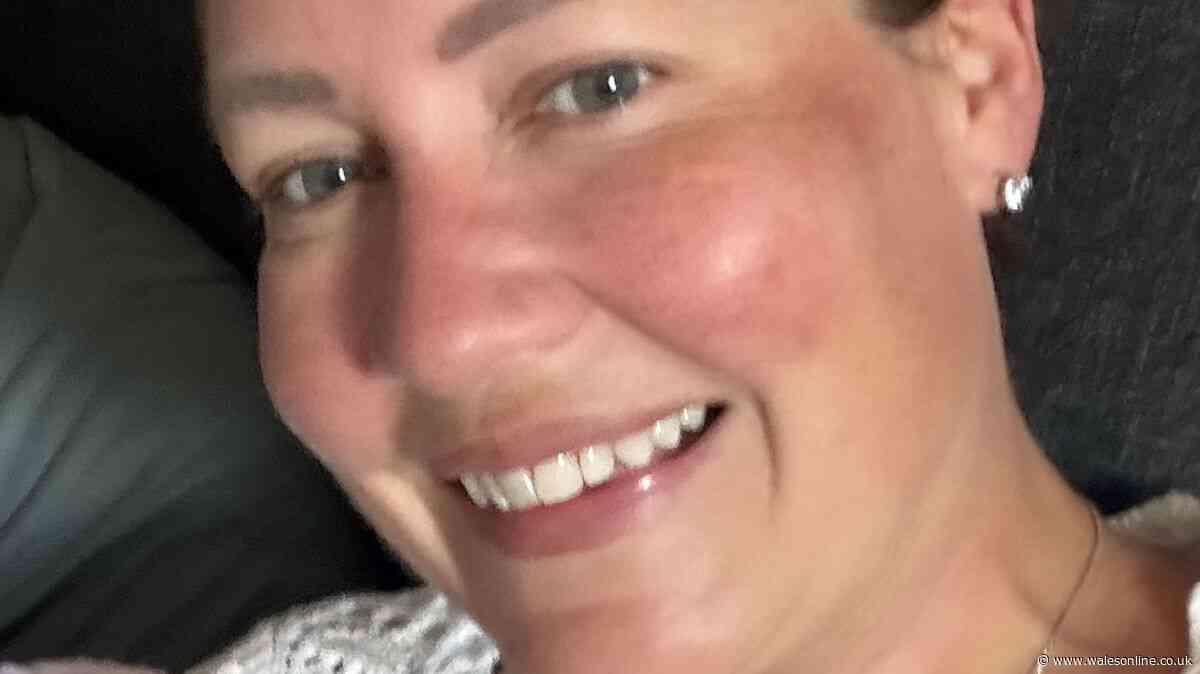 'I haven't used my own garden for years due to false widow infestation'