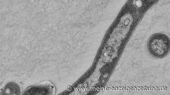 Tuberkulose-Skandal an Mailänder Uni: Ärzte infiziert, Protokolle ignoriert – jetzt droht Anzeige