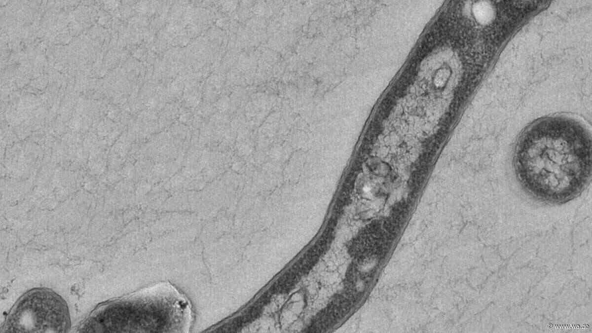 Tuberkulose-Skandal an Mailänder Uni: Ärzte infiziert, Protokolle ignoriert – jetzt droht Anzeige