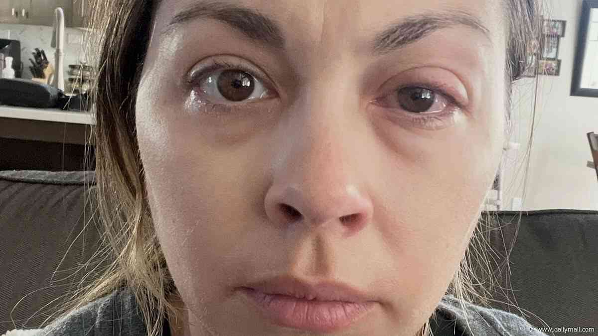 I thought sleeping with my make-up on was harmless. Now I've got this terrifying condition that affects 1 in 5 people. Doctors say it's too late for me - I'm going to suffer this agony for life. Don't make my mistake