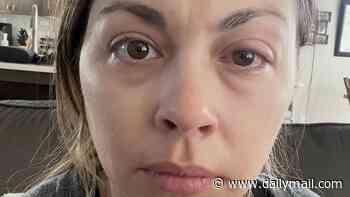 I thought sleeping with my make-up on was harmless. Now I've got this terrifying condition that affects 1 in 5 people. Doctors say it's too late for me - I'm going to suffer this agony for life. Don't make my mistake