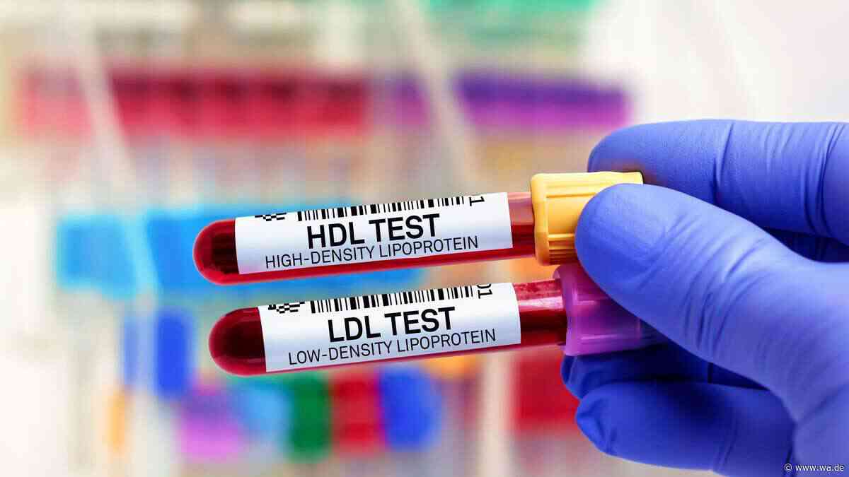 Welchen Einfluss die Ernährung auf den Cholesterinwert haben kann
