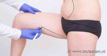 Lipofilling wordt steeds populairder: hoe veilig is deze vettransplantatie?