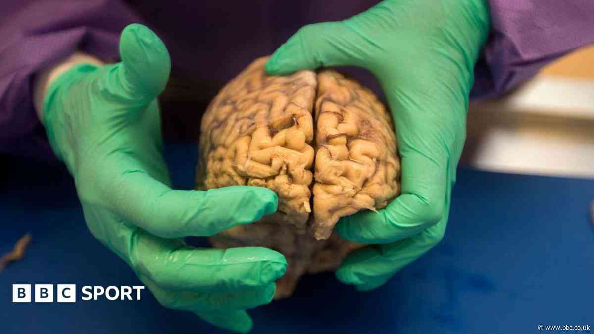Brain disease in dead NFL players 'higher than previously shown'