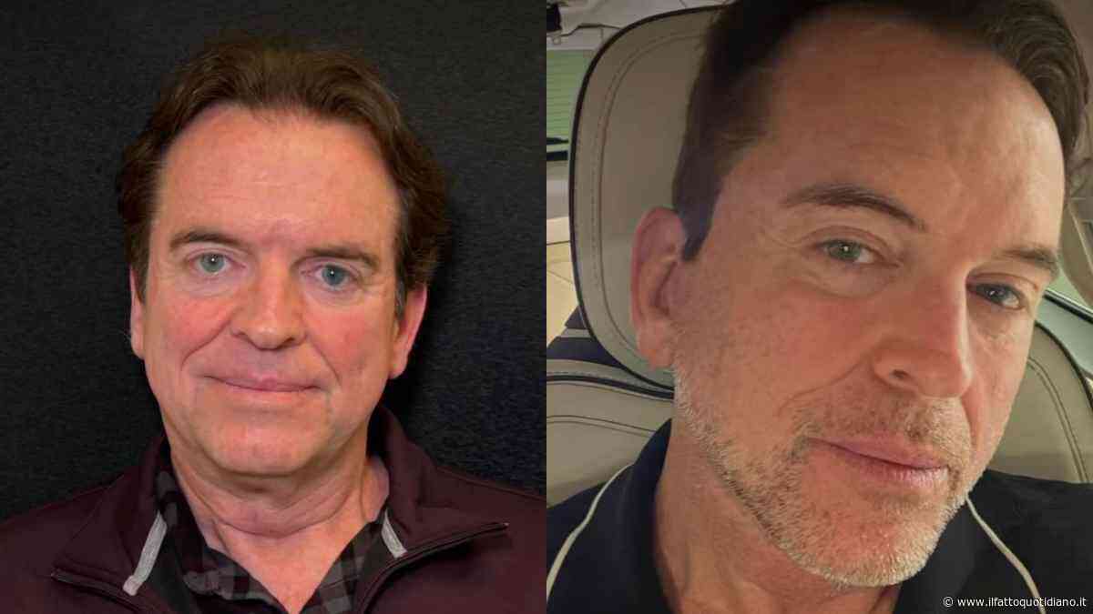 “Ho fatto un lifting a 59 anni. La pelle degli uomini è più pesante, è più spessa, presenta peli: l’operazione è durata otto ore ma oggi mi sento me stesso”. La storia di Jeff