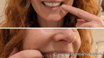 Mum's gums 'bled for 11 years' after kids were born until she used 32p-a-go serum