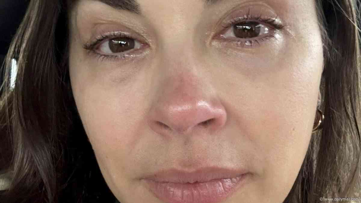 I thought sleeping with my make-up on was harmless. Now I've got a terrifying condition and doctors say it's too late for me - I'm going to suffer this agony for life. Don't make my mistake