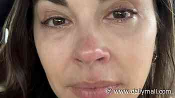 I thought sleeping with my make-up on was harmless. Now I've got a terrifying condition and doctors say it's too late for me - I'm going to suffer this agony for life. Don't make my mistake