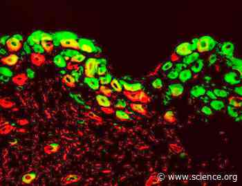 BRAF recruitment to spinal sensory synapses promotes neuropathic pain by potentiating transsynaptic NMDA receptor activity | Science Signaling