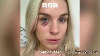 Skin cancer survivor calls for end to sunscreen VAT
