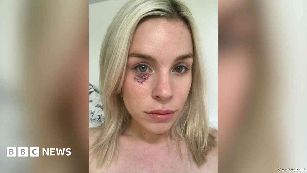 Cancer patient fights to scrap VAT on sunscreen