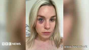 Cancer patient fights to scrap VAT on sunscreen