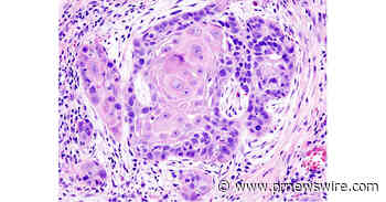 Mapping Smarter Drug Delivery for Treating Oral Cancers: A Hasanuddin University Review