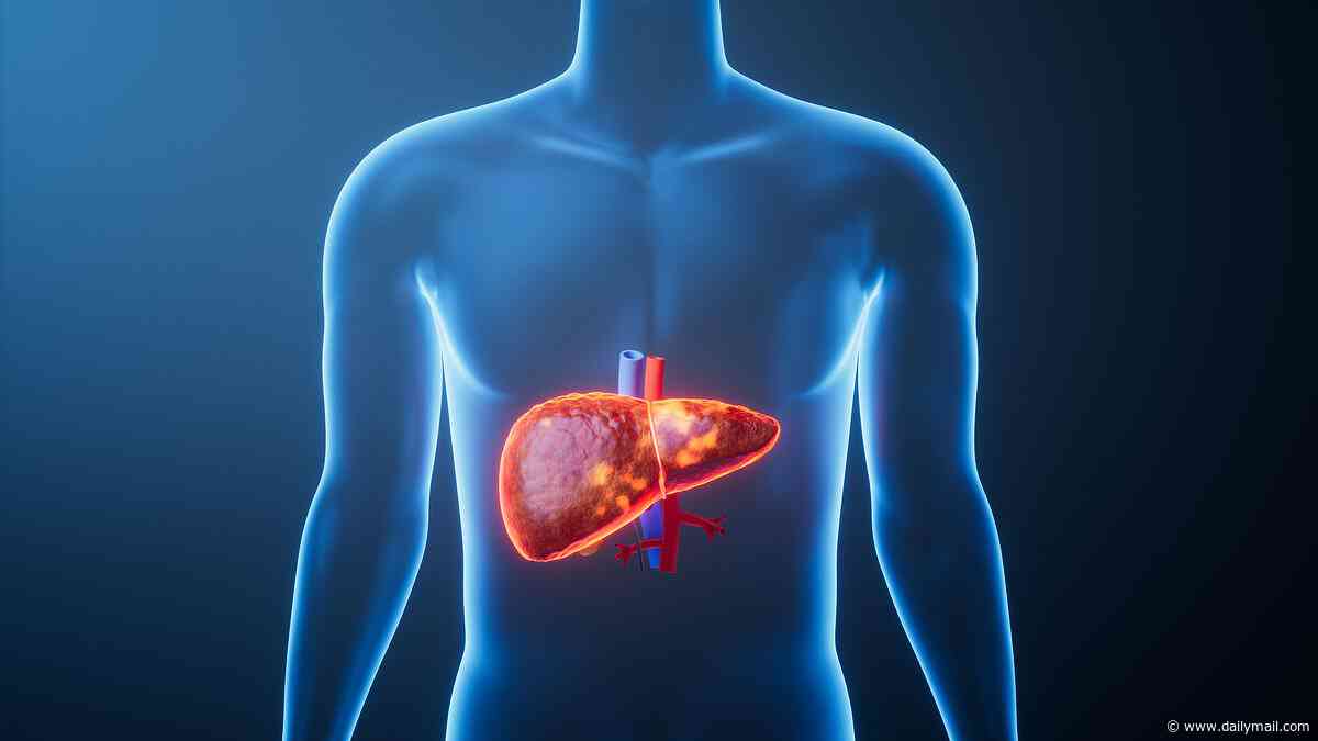 Warning over staggering five-fold surge in deadly liver disease that's 'underdiagnosed' - experts reveal red flags to watch out for