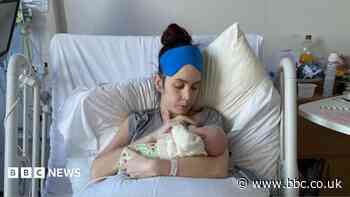 Mum's perforated bowel ordeal after scan error