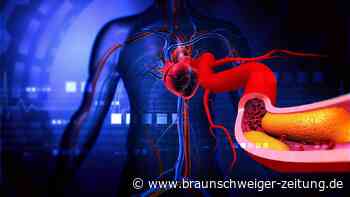 Cholesterin senken mit Statinen: Ärztin beseitigt Angst vor Nebenwirkungen
