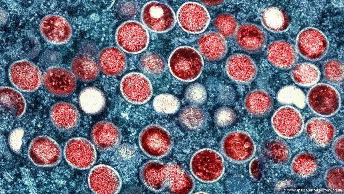 Mpox weitet sich in Berlin auf weitere Personengruppen aus
