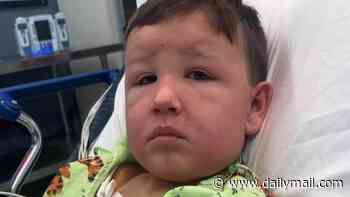 Midwest boy, 7, nearly DIED after completing common garden chore for his stepmom without gloves on