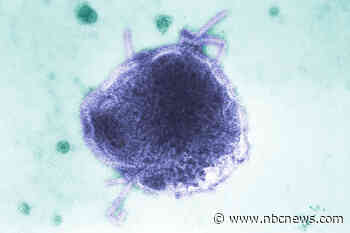 Infant in Pennsylvania is one of two people reported to die of measles this week