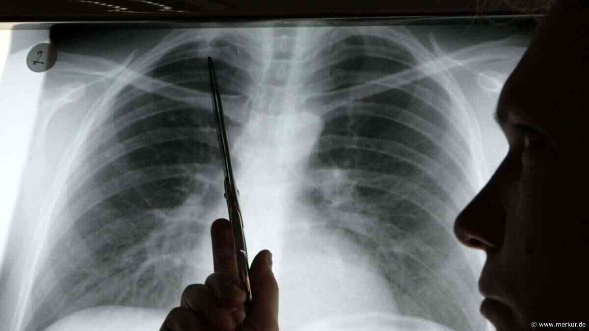 Hartnäckiger Husten als Warnsignal: Junge Frau erhält schockierende Krebsdiagnose
