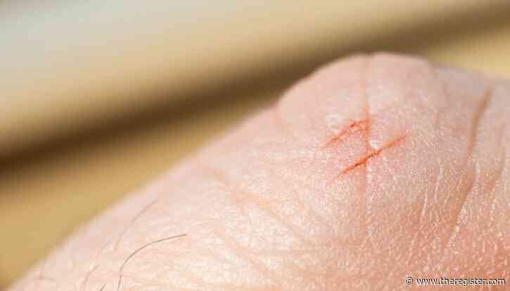 Print management outfit PaperCut is under 0-day attack, and it’s drawing customers’ blood