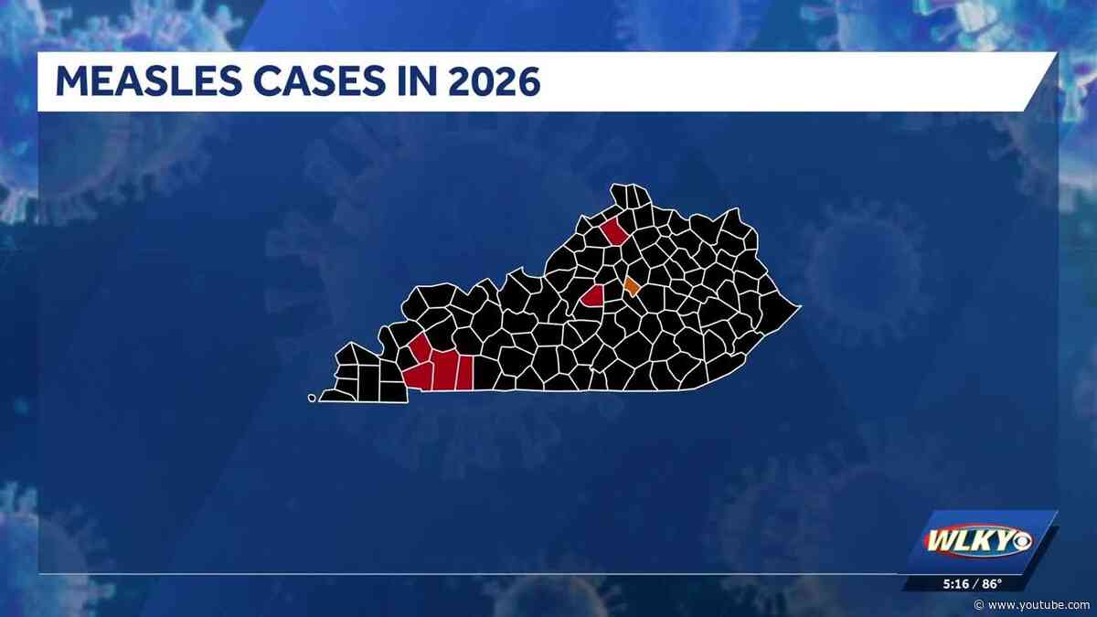 Kentucky health officials give measles update, one new case confirmed