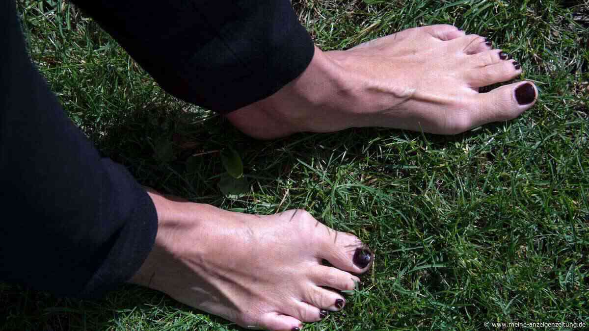 Hallux valgus: Was tun bei familiärer Vorbelastung?