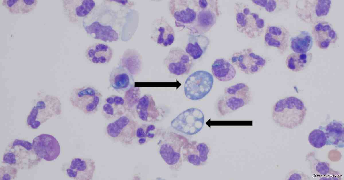 Warming waters could expand brain-eating amoeba risk
