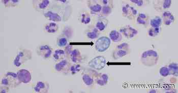 Warming waters could expand brain-eating amoeba risk