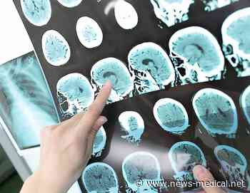 New stroke guidelines could help pave the way for precision rehabilitation