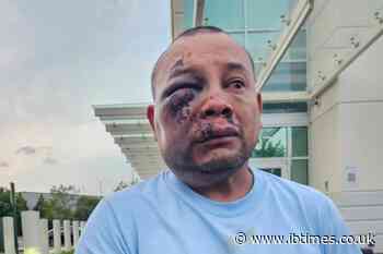 Virginia Man Says ICE Encounter Landed Him in Hospital With a Brain Bleed, Now Police Are Investigating