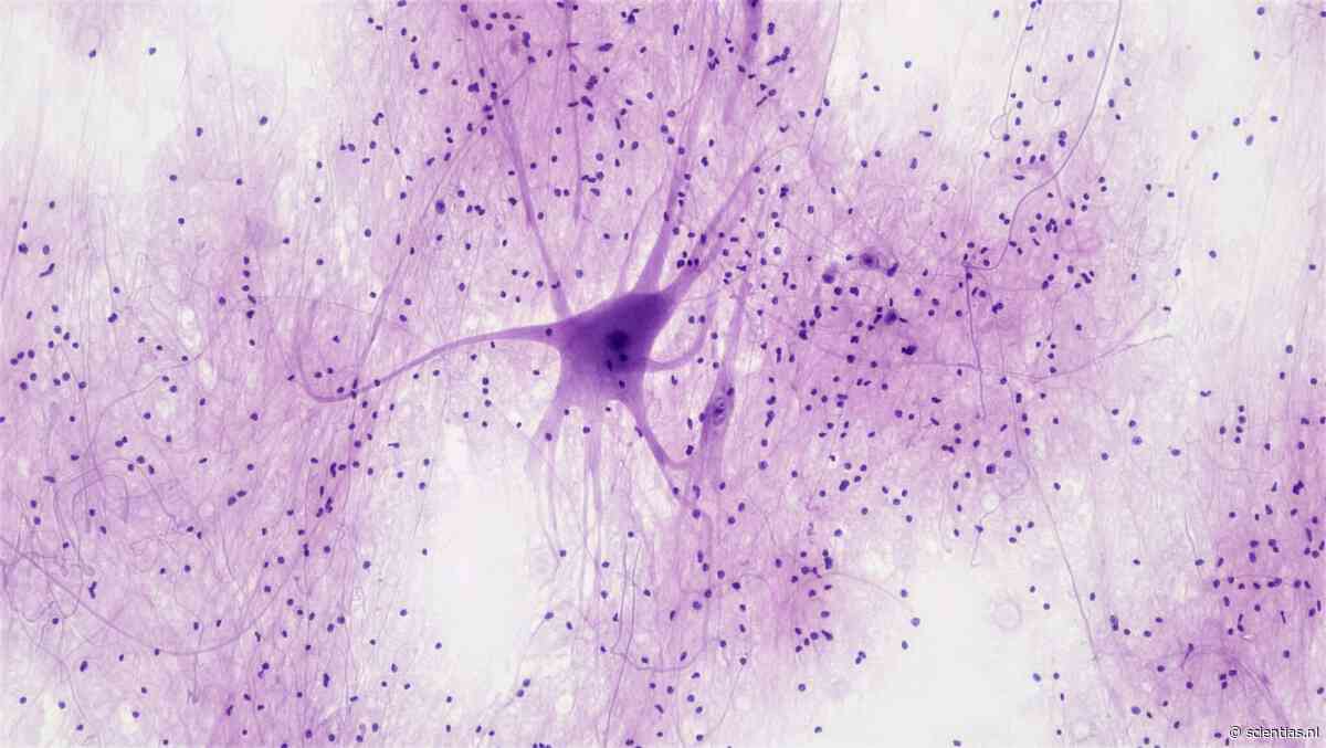Nanodeeltjes maken nieuwe neuronen in het brein van muizen met alzheimer