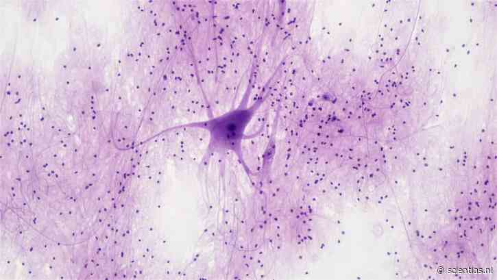 Nanodeeltjes maken nieuwe neuronen in het brein van muizen met alzheimer