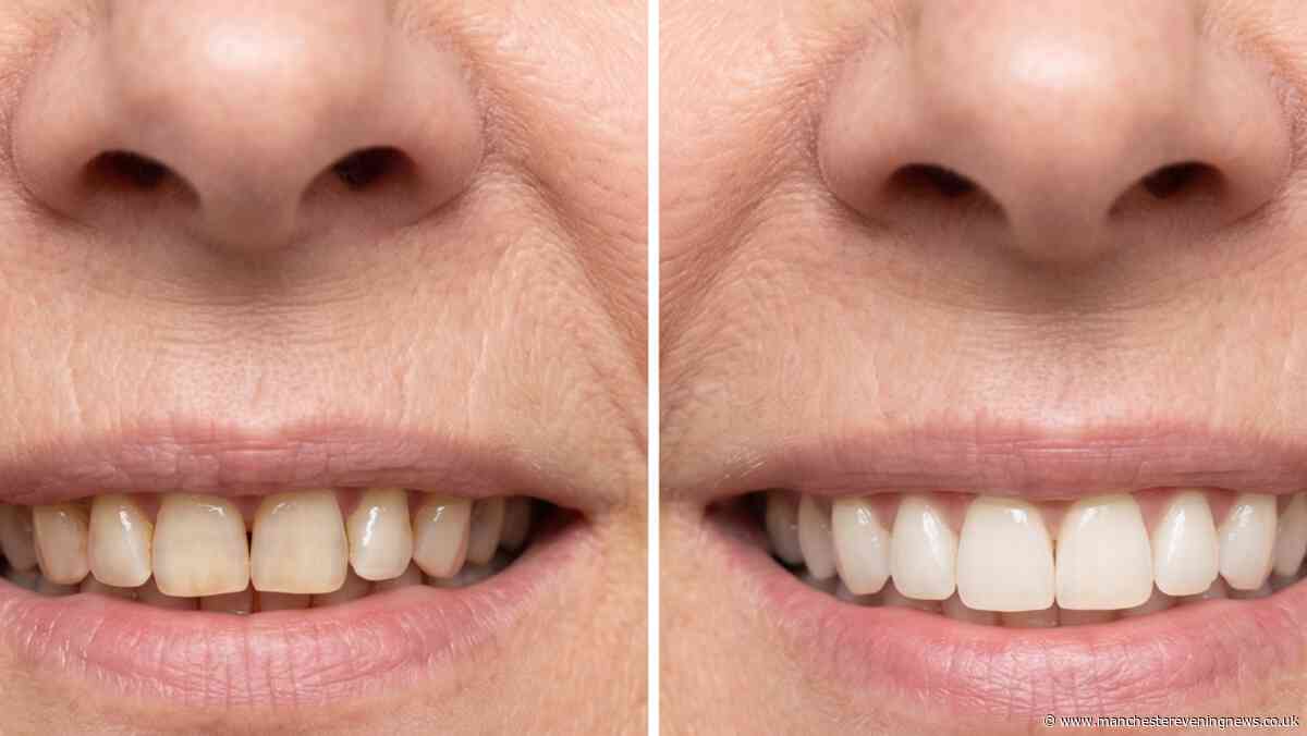 Woman gets 'sparkling teeth' with award-winning £21 whitening solution