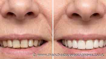 Woman gets 'sparkling teeth' with award-winning £21 whitening solution