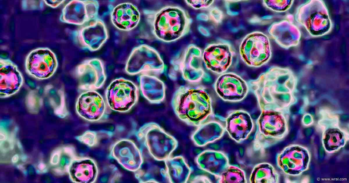 Possible measles exposure at Holiday Inn Express in Asheville