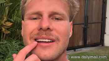 Aussies issued wake-up call about cheap dental work in Bali: 'Unexpected complications'