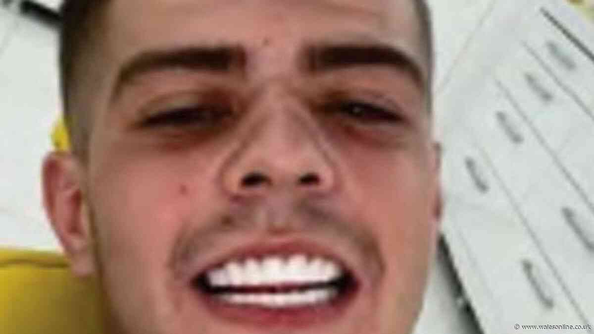 Criminal with 'Turkey teeth' to pay back just £795 after benefiting by £36,000