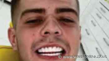 Criminal with 'Turkey teeth' to pay back just £795 after benefiting by £36,000