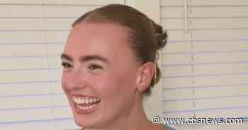 Atlanta nurse undergoes brain surgery days after unexpected discovery