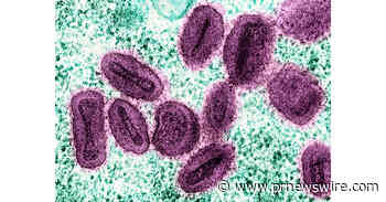 Mathematical Model Shows 97.8% Reduction in Simulated Mpox Infections Under a Four-Intervention Strategy