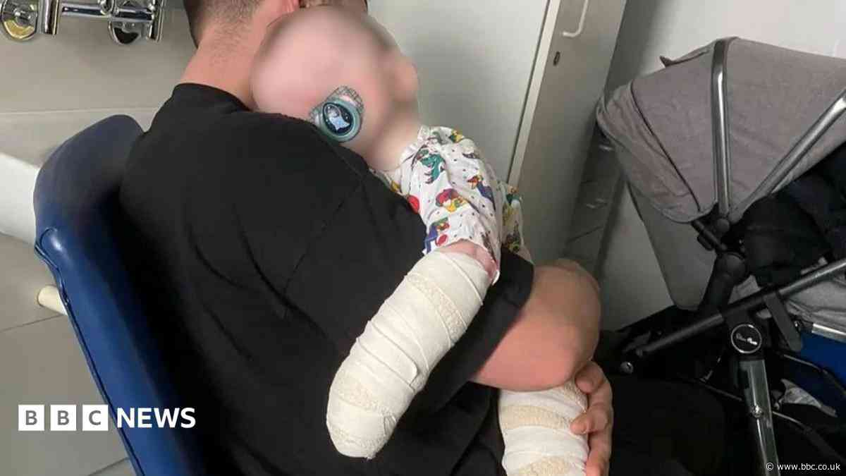 Nursery fined after baby boy burned by bleach