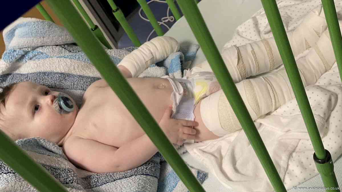 Baby left with second-degree burns after being burnt by bleach and hot water at nursery