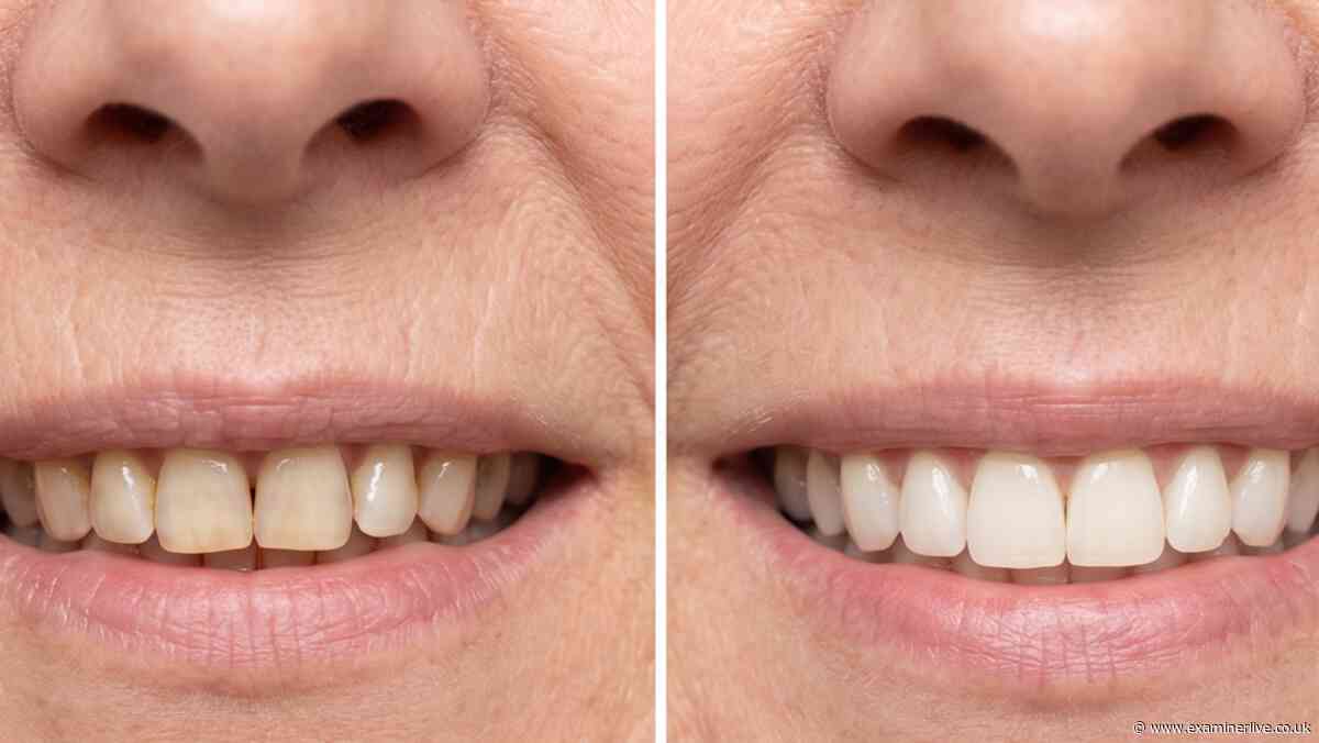 Woman, 60, says teeth 'were a shade of yuk' before 27p-a-day took '30 years' off